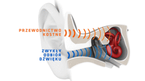 AfterShokz_Trekz_Titanium_Bone_Conduction_PL